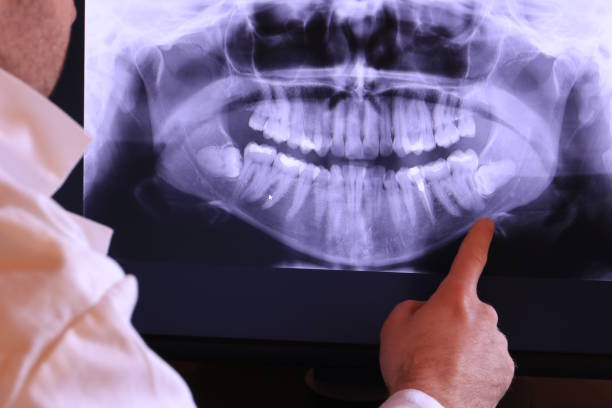 Best Emergency Cosmetic Dentistry (e.g., broken veneers) in Columbia, MS