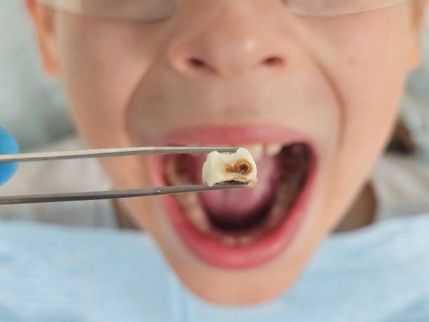 Best Urgent Dental Care for Toothaches in Columbia, MS
